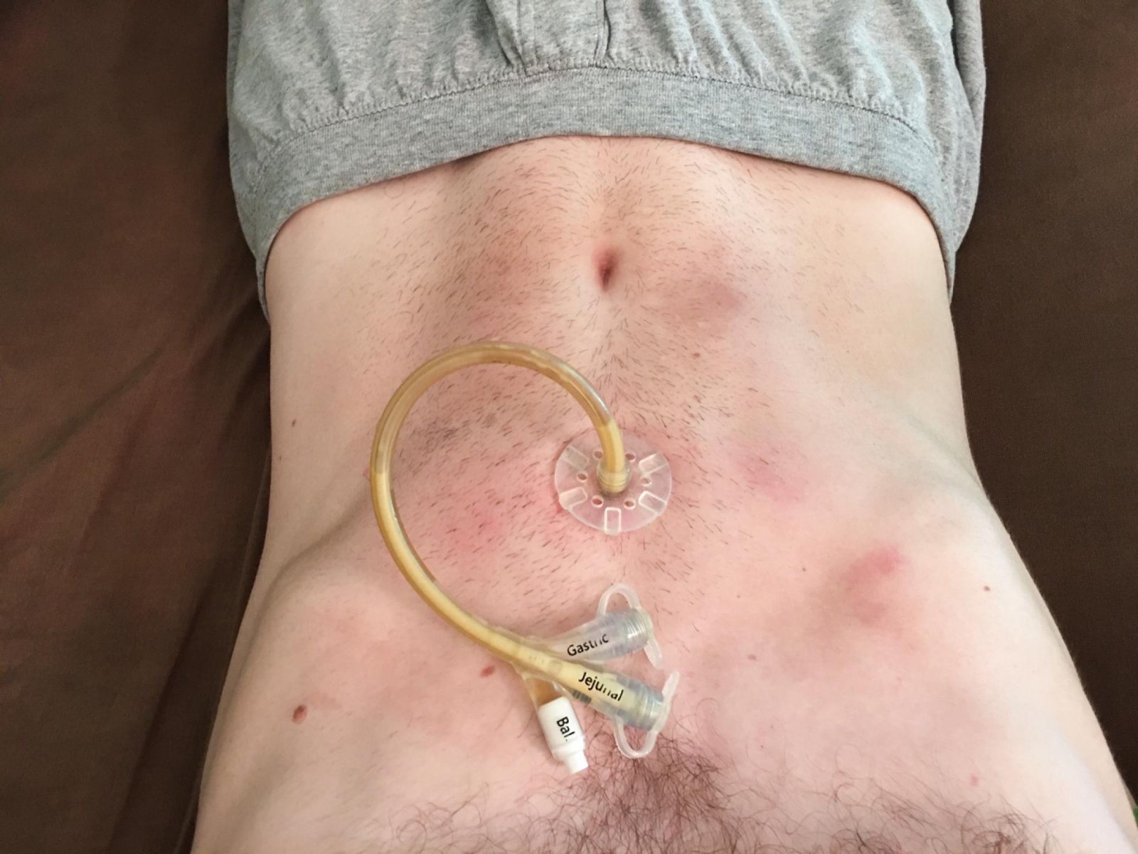 European Photography Awards Winner - The Living Death