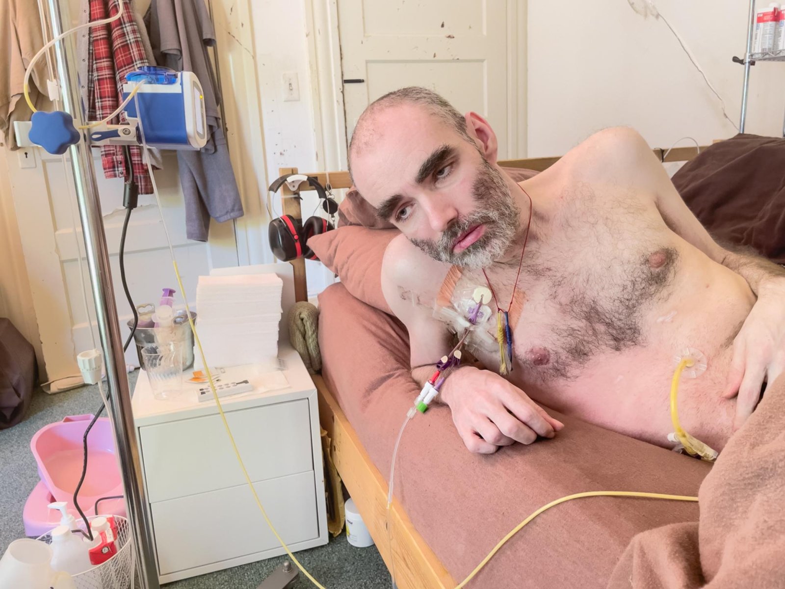 European Photography Awards Winner - The Living Death