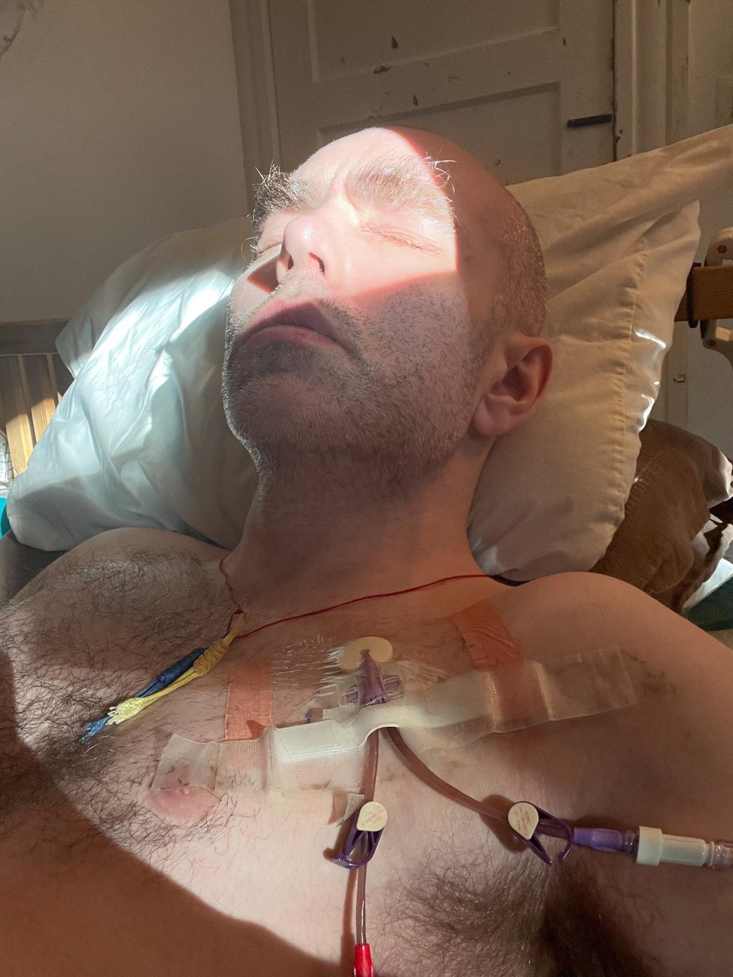 European Photography Awards Winner - The Living Death