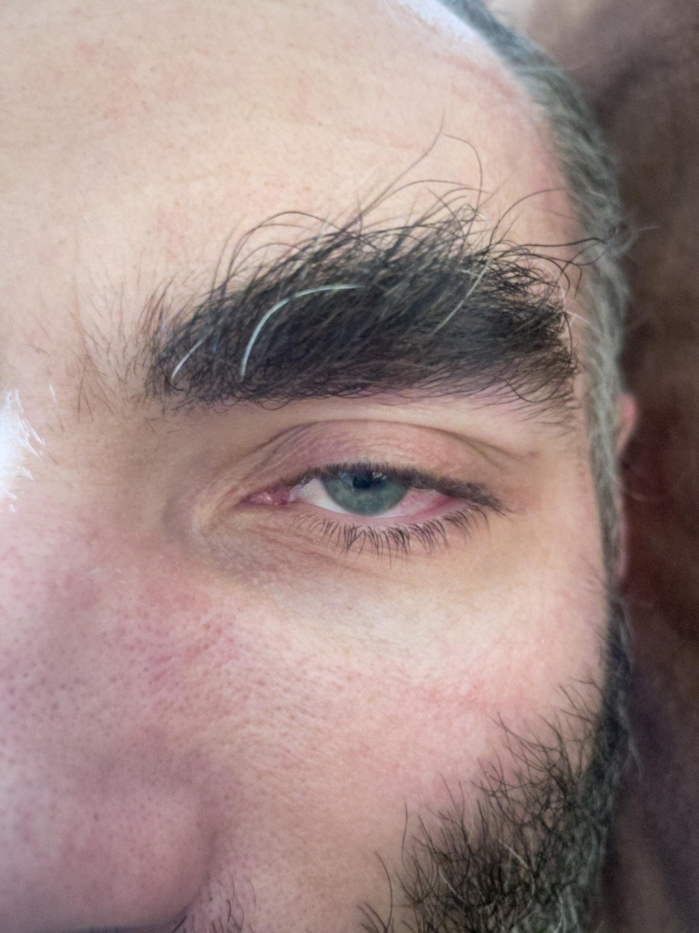 European Photography Awards Winner - The Living Death