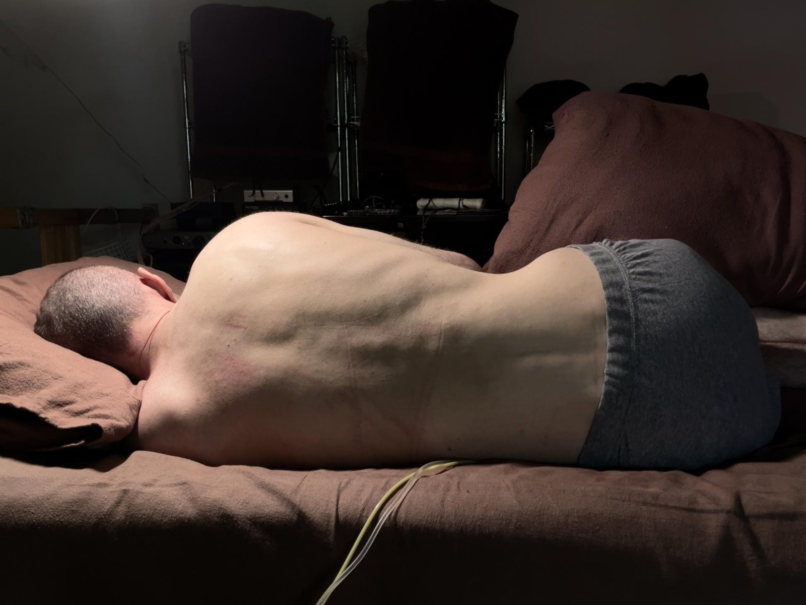 European Photography Awards Winner - The Living Death