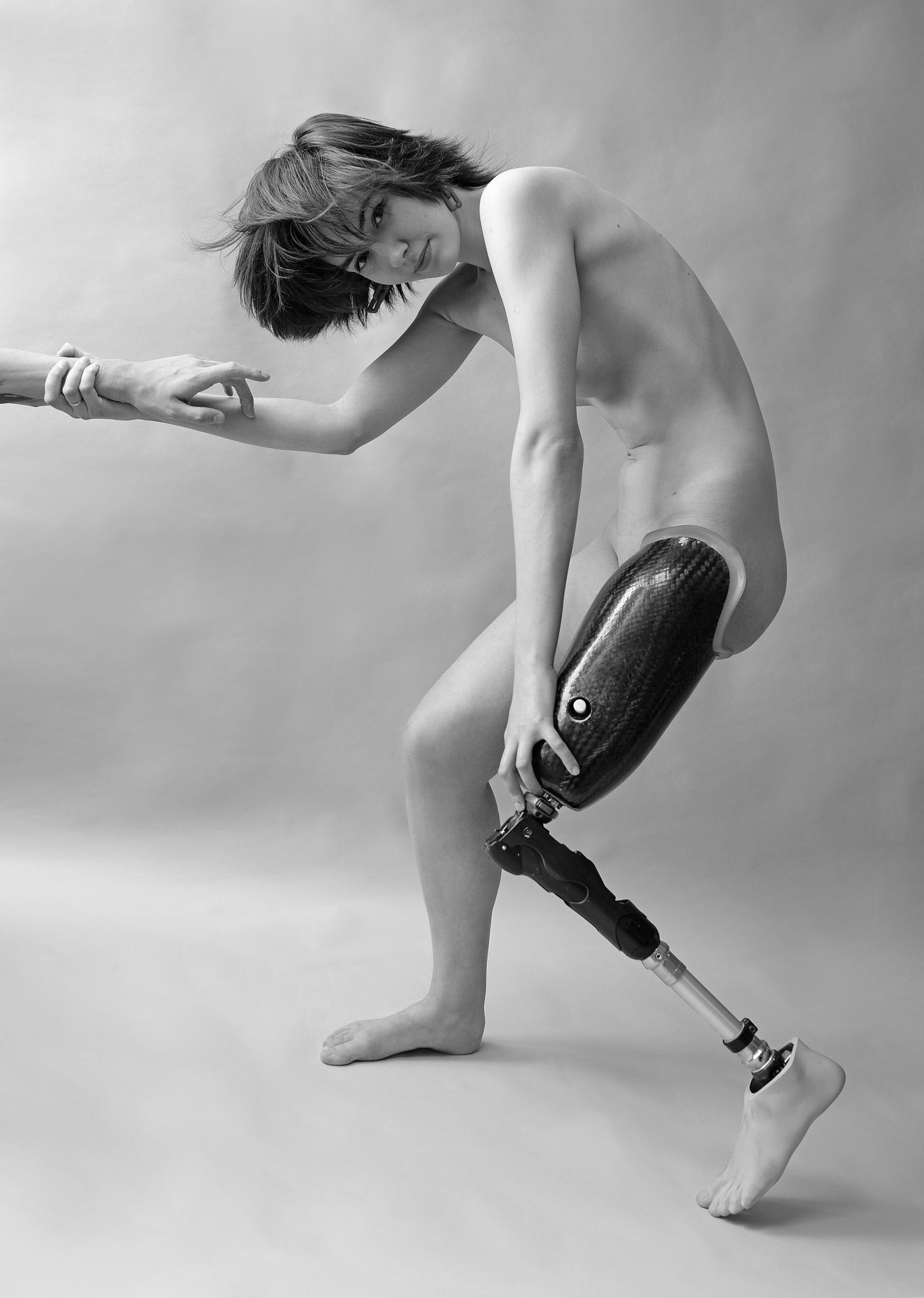 European Photography Awards Winner - Life On A Prosthesis.
