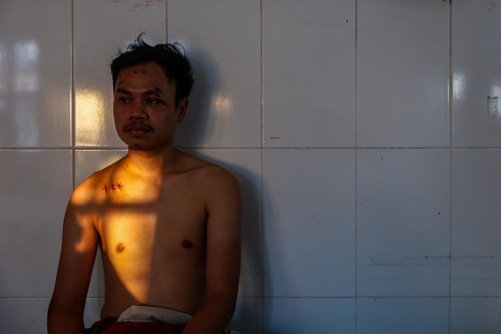 European Photography Awards Winner - Scars of War: Deadliest Thai-Cambodian Conflict